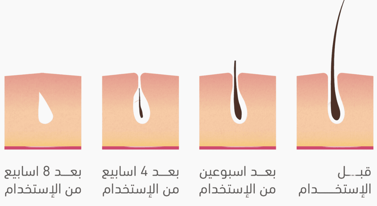ملاي